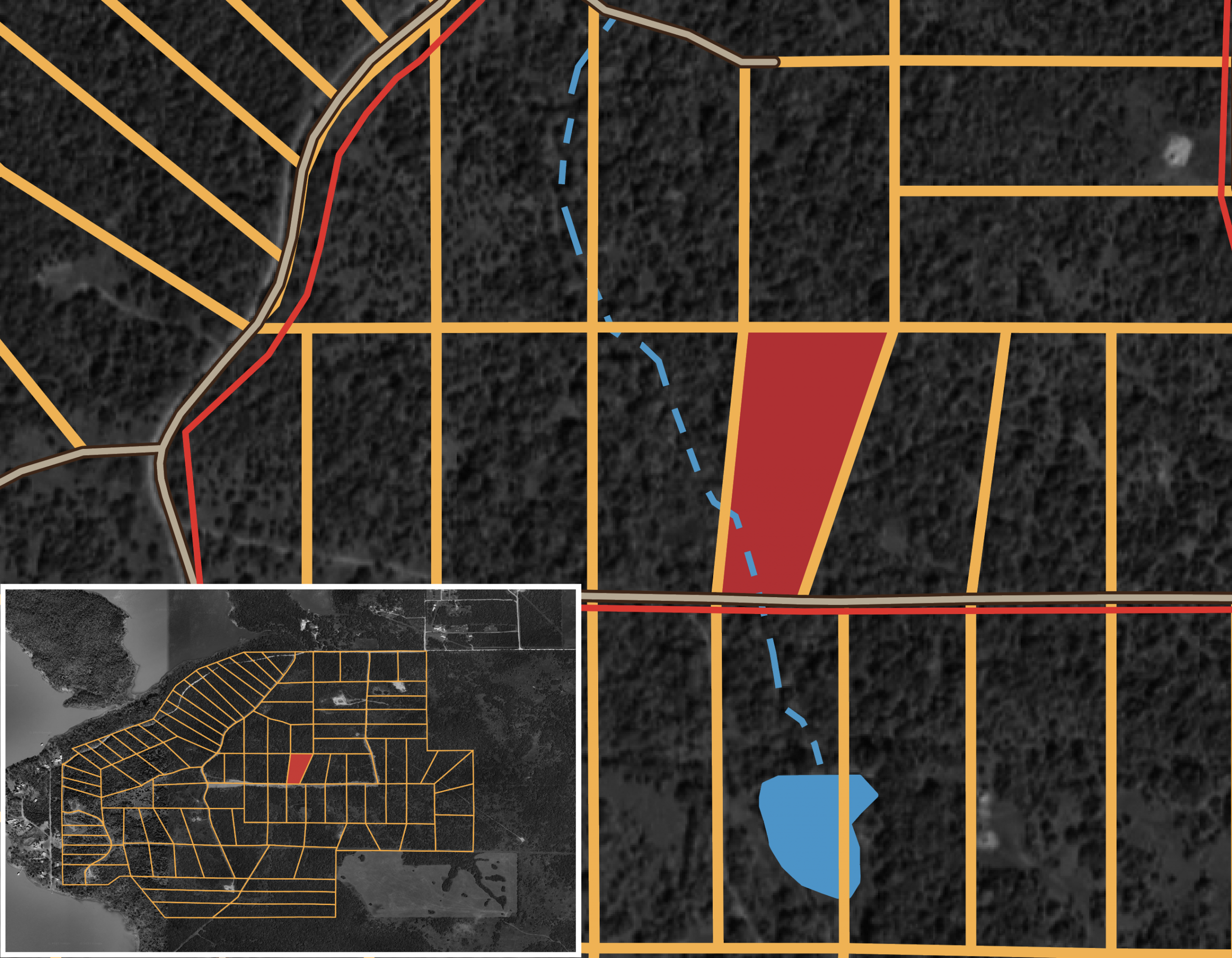 RCCPII-T75 tract image